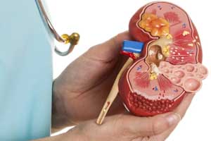 гломерулонефрит