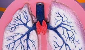 признаки рака тимуса