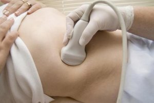 парапельвикальные кисты обеих почек прогноз жизни. Смотреть фото парапельвикальные кисты обеих почек прогноз жизни. Смотреть картинку парапельвикальные кисты обеих почек прогноз жизни. Картинка про парапельвикальные кисты обеих почек прогноз жизни. Фото парапельвикальные кисты обеих почек прогноз жизни