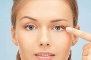 Лечение птоза верхнего века в Израиле 