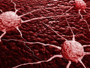 Диагностика метастазов