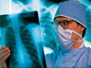 Прогноз рака легких в Израиле