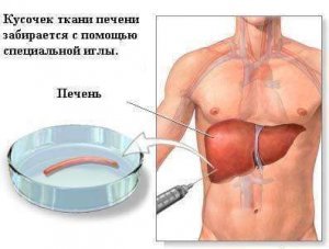 Лечение рака печени в Израиле. Диагностика, обследование, цены | Лечение в Израиле