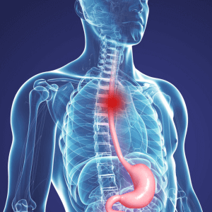 симптомы рака пищевода