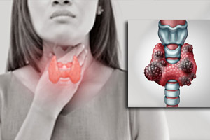 рак паращитовидной железы