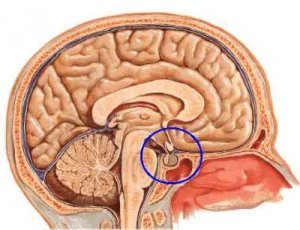 Лечение рака гипофиза