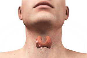 лимфома щитовидной железы