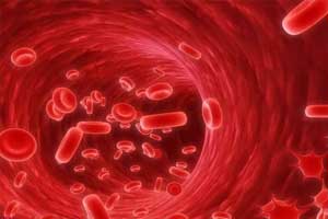 гематосаркома