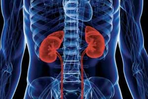 Гипернефрома