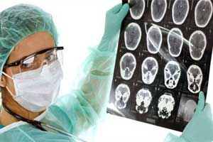 глиома хиазмы