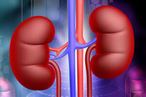 дистопия почки