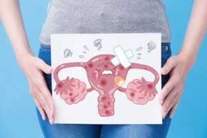 лейомиосаркома