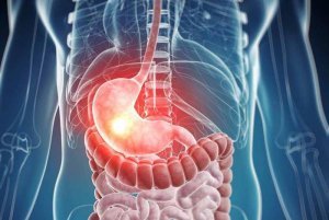 Гастроэнтерология в Израиле