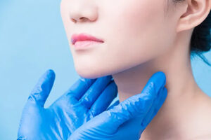 Лечение центроцитарной лимфомы в Израиле 